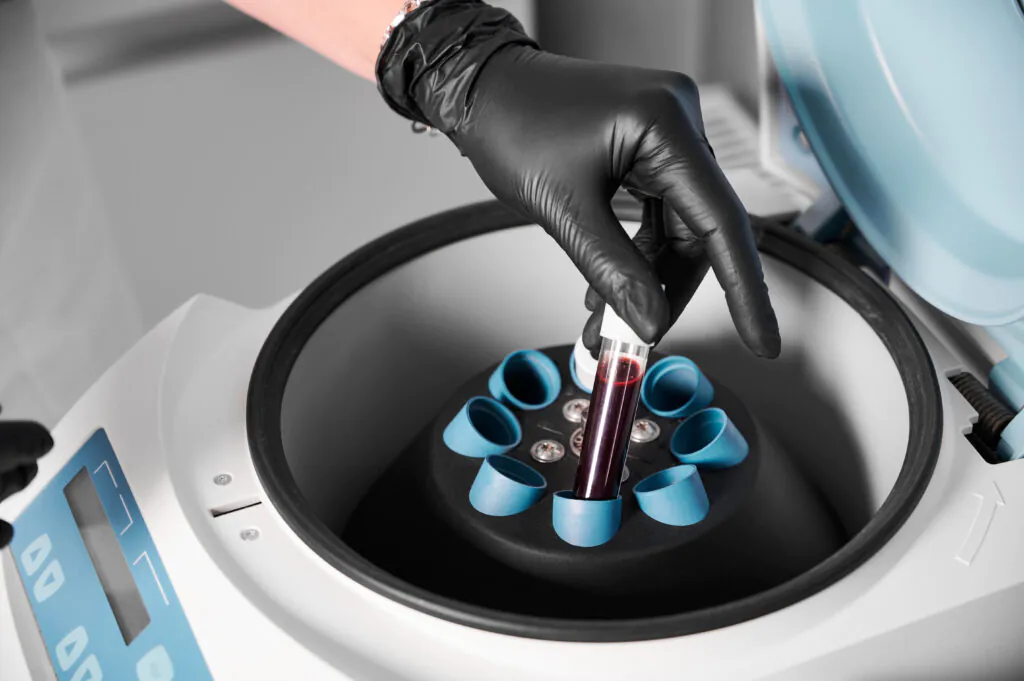przygotowanie krwi do wstrzykiwan kosmetolog umieszcza probowke z krwia w wirowce